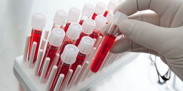 blood test
